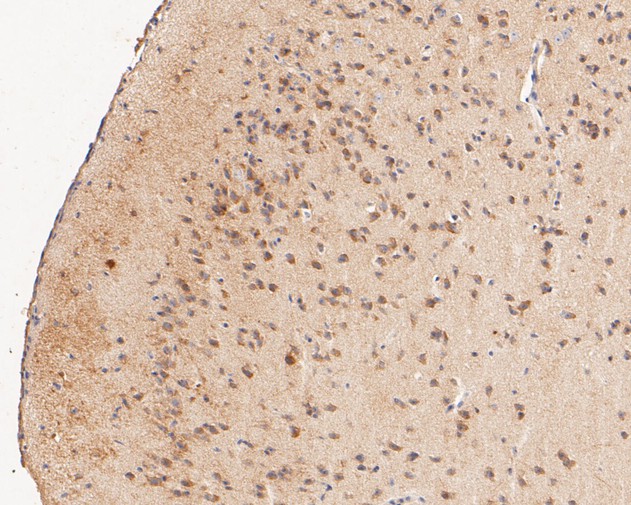 Paraformaldehyde-fixed, paraffin embedded Mouse brain; Antigen retrieval by boiling in sodium citrate buffer (pH6.0) for 15min; Block endogenous peroxidase by 3% hydrogen peroxide for 20 minutes; Blocking buffer (normal goat serum) at 37°C for 30min; Antibody incubation with Tropomodulin 2 Monoclonal Antibody, Unconjugated (bsm-54701R) at 1:50 for 30 minutes at room temperature, DAB staining.