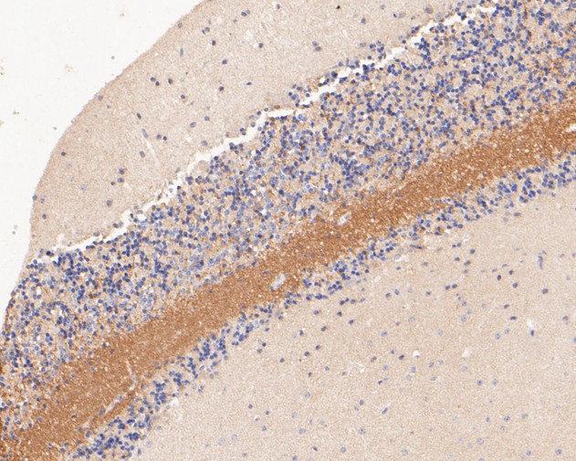 Paraformaldehyde-fixed, paraffin embedded Mouse cerebellum; Antigen retrieval by boiling in sodium citrate buffer (pH6.0) for 15min; Block endogenous peroxidase by 3% hydrogen peroxide for 20 minutes; Blocking buffer (normal goat serum) at 37°C for 30min; Antibody incubation with Tropomodulin 2 Monoclonal Antibody, Unconjugated (bsm-54701R) at 1:50 for 30 minutes at room temperature, DAB staining.