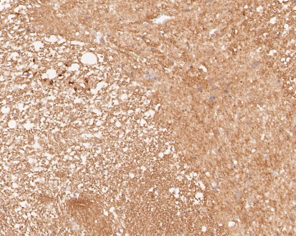 Paraformaldehyde-fixed, paraffin embedded Rat spinal cord; Antigen retrieval by boiling in sodium citrate buffer (pH6.0) for 15min; Block endogenous peroxidase by 3% hydrogen peroxide for 20 minutes; Blocking buffer (normal goat serum) at 37°C for 30min; Antibody incubation with Tropomodulin 2 Monoclonal Antibody, Unconjugated (bsm-54701R) at 1:50 for 30 minutes at room temperature, DAB staining.