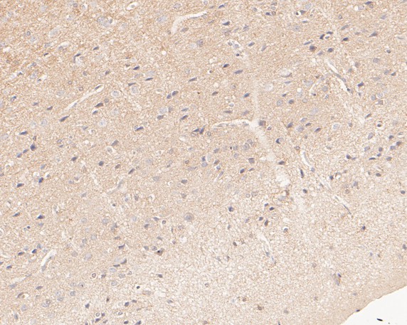 Paraformaldehyde-fixed, paraffin embedded Rat brain; Antigen retrieval by boiling in sodium citrate buffer (pH6.0) for 15min; Block endogenous peroxidase by 3% hydrogen peroxide for 20 minutes; Blocking buffer (normal goat serum) at 37°C for 30min; Antibody incubation with Tropomodulin 2 Monoclonal Antibody, Unconjugated (bsm-54701R) at 1:50 for 30 minutes at room temperature, DAB staining.