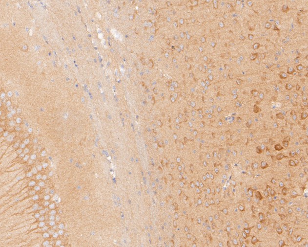 Paraformaldehyde-fixed, paraffin embedded Mouse brain; Antigen retrieval by boiling in sodium citrate buffer (pH6.0) for 15min; Block endogenous peroxidase by 3% hydrogen peroxide for 20 minutes; Blocking buffer (normal goat serum) at 37°C for 30min; Antibody incubation with KIFAP3 Monoclonal Antibody, Unconjugated (bsm-54702R) at 1:200 for 30 minutes at room temperature, DAB staining.