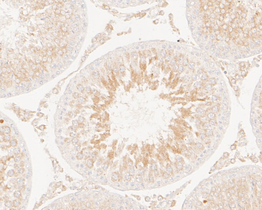 Paraformaldehyde-fixed, paraffin embedded Rat testis; Antigen retrieval by boiling in sodium citrate buffer (pH6.0) for 15min; Block endogenous peroxidase by 3% hydrogen peroxide for 20 minutes; Blocking buffer (normal goat serum) at 37°C for 30min; Antibody incubation with KIFAP3 Monoclonal Antibody, Unconjugated (bsm-54702R) at 1:50 for 30 minutes at room temperature, DAB staining.