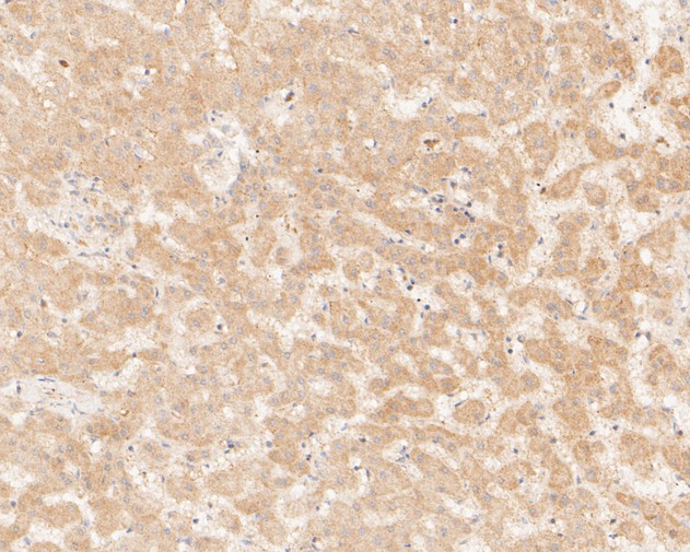 Paraformaldehyde-fixed, paraffin embedded Human liver; Antigen retrieval by boiling in sodium citrate buffer (pH6.0) for 15min; Block endogenous peroxidase by 3% hydrogen peroxide for 20 minutes; Blocking buffer (normal goat serum) at 37°C for 30min; Antibody incubation with KIFAP3 Monoclonal Antibody, Unconjugated (bsm-54702R) at 1:50 for 30 minutes at room temperature, DAB staining.