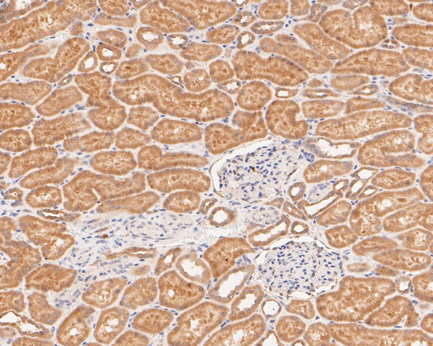 Paraformaldehyde-fixed, paraffin embedded Human kidney; Antigen retrieval by boiling in sodium citrate buffer (pH6.0) for 15min; Block endogenous peroxidase by 3% hydrogen peroxide for 20 minutes; Blocking buffer (normal goat serum) at 37°C for 30min; Antibody incubation with KIFAP3 Monoclonal Antibody, Unconjugated (bsm-54702R) at 1:200 for 30 minutes at room temperature, DAB staining.