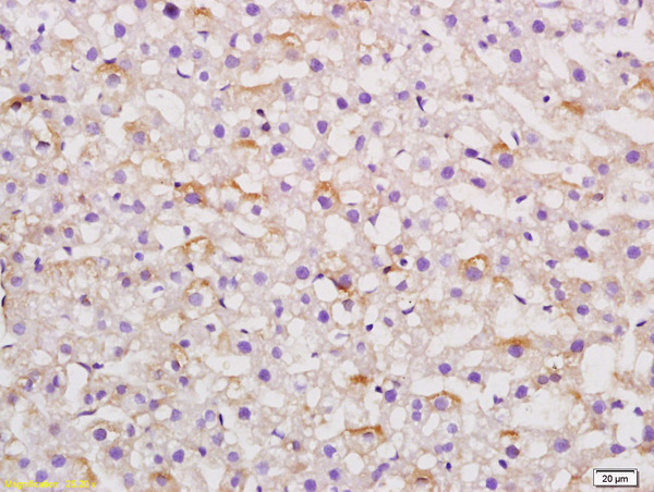 Formalin-fixed and paraffin embedded rat liver labeled with Anti AGT Polyclonal Antibody,Unconjugated (bs-0045M) at 1:200 followed by conjugation to the secondary antibody and DAB staining.