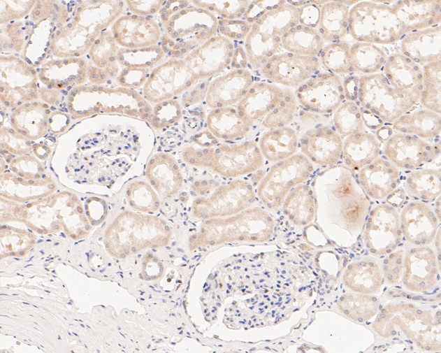 Paraformaldehyde-fixed, paraffin embedded Human kidney; Antigen retrieval by boiling in sodium citrate buffer (pH6.0) for 15min; Block endogenous peroxidase by 3% hydrogen peroxide for 20 minutes; Blocking buffer (normal goat serum) at 37°C for 30min; Antibody incubation with SENP2 Monoclonal Antibody, Unconjugated (bsm-54707R) at 1:50 for 30 minutes at room temperature, DAB staining.