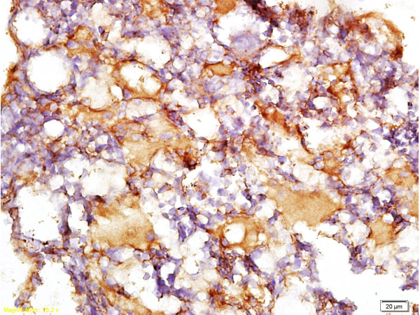 Formalin-fixed and paraffin embedded rat liver tissue with Anti-Collagen IV Polyclonal Antibody, Unconjugated (bs-0806R) at 1:200, followed by conjugation to the secondary antibody and DAB staining\n