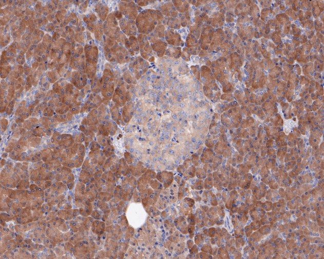 Paraformaldehyde-fixed, paraffin embedded Human pancreas; Antigen retrieval by boiling in sodium citrate buffer (pH6.0) for 15min; Block endogenous peroxidase by 3% hydrogen peroxide for 20 minutes; Blocking buffer (normal goat serum) at 37°C for 30min; Antibody incubation with SPAK Monoclonal Antibody, Unconjugated (bsm-54711R) at 1:50 for 30 minutes at room temperature, DAB staining.