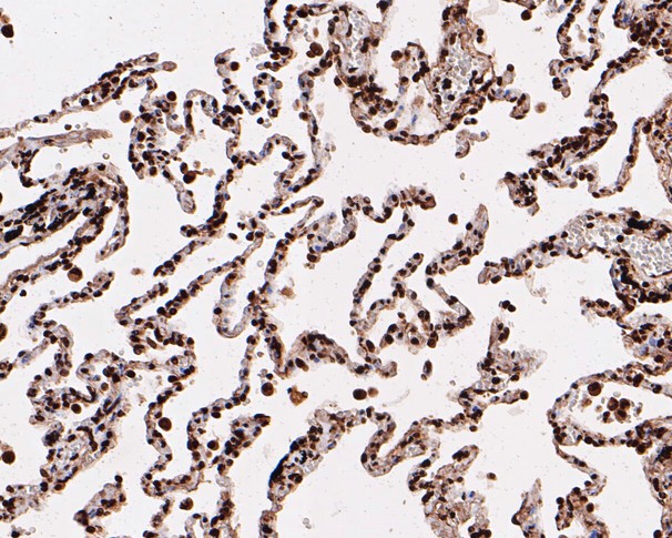 Paraformaldehyde-fixed, paraffin embedded Human lung; Antigen retrieval by boiling in sodium citrate buffer (pH6.0) for 15min; Block endogenous peroxidase by 3% hydrogen peroxide for 20 minutes; Blocking buffer (normal goat serum) at 37°C for 30min; Antibody incubation with HMGN2 Monoclonal Antibody, Unconjugated (bsm-54712R) at 1:200 for 30 minutes at room temperature, DAB staining.