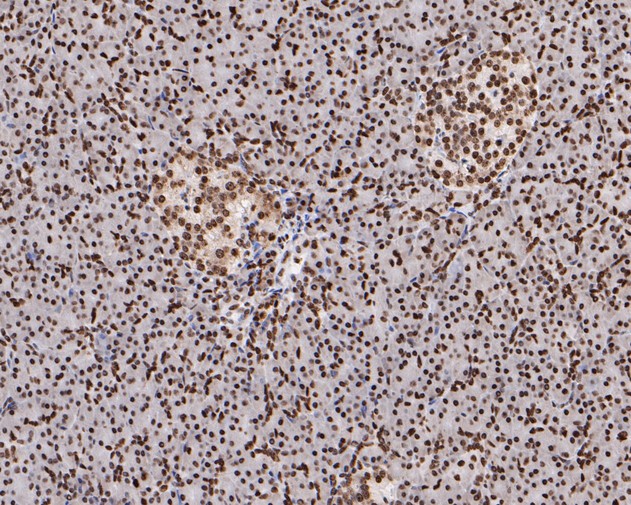 Paraformaldehyde-fixed, paraffin embedded Human pancreas; Antigen retrieval by boiling in sodium citrate buffer (pH6.0) for 15min; Block endogenous peroxidase by 3% hydrogen peroxide for 20 minutes; Blocking buffer (normal goat serum) at 37°C for 30min; Antibody incubation with HMGN2 Monoclonal Antibody, Unconjugated (bsm-54712R) at 1:200 for 30 minutes at room temperature, DAB staining.