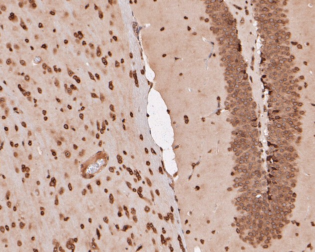 Paraformaldehyde-fixed, paraffin embedded Mouse brain; Antigen retrieval by boiling in sodium citrate buffer (pH6.0) for 15min; Block endogenous peroxidase by 3% hydrogen peroxide for 20 minutes; Blocking buffer (normal goat serum) at 37°C for 30min; Antibody incubation with eIF3e Monoclonal Antibody, Unconjugated (bsm-54714R) at 1:50 for 30 minutes at room temperature, DAB staining.