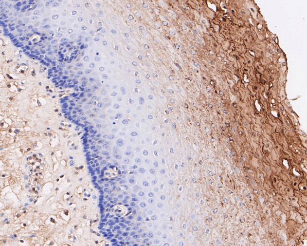 Paraformaldehyde-fixed, paraffin embedded Human esophagus; Antigen retrieval by boiling in sodium citrate buffer (pH6.0) for 15min; Block endogenous peroxidase by 3% hydrogen peroxide for 20 minutes; Blocking buffer (normal goat serum) at 37°C for 30min; Antibody incubation with ECM1 Monoclonal Antibody, Unconjugated (bsm-54715R) at 1:50 for 30 minutes at room temperature, DAB staining.