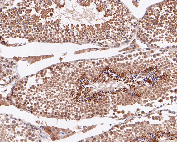 Paraformaldehyde-fixed, paraffin embedded Mouse testis; Antigen retrieval by boiling in sodium citrate buffer (pH6.0) for 15min; Block endogenous peroxidase by 3% hydrogen peroxide for 20 minutes; Blocking buffer (normal goat serum) at 37°C for 30min; Antibody incubation with ABI2 Monoclonal Antibody, Unconjugated (bsm-54716R) at 1:50 for 30 minutes at room temperature, DAB staining. Paraformaldehyde-fixed, paraffin embedded Mouse testis; Antigen retrieval by boiling in sodium citrate buffer (pH6.0) for 15min; Block endogenous peroxidase by 3% hydrogen peroxide for 20 minutes; Blocking buffer (normal goat serum) at 37°C for 30min; Antibody incubation with ABI2 Monoclonal Antibody, Unconjugated (bsm-54716R) at 1:50 for 30 minutes at room temperature, DAB staining.
