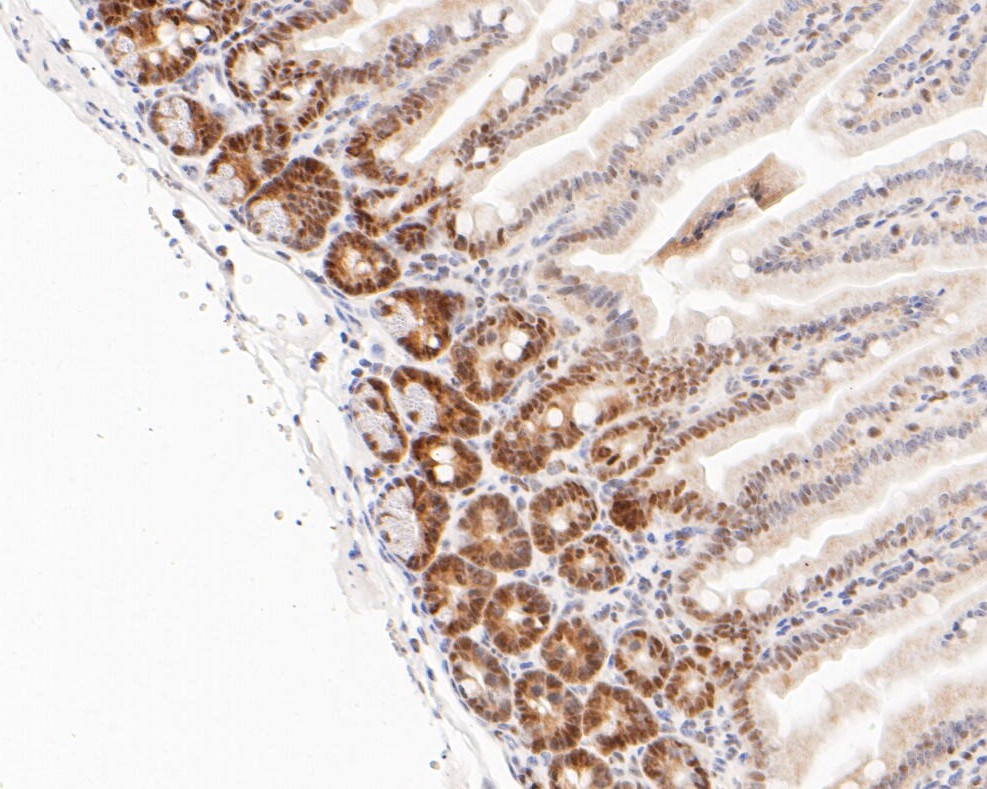 Paraformaldehyde-fixed, paraffin embedded Mouse colon; Antigen retrieval by boiling in sodium citrate buffer (pH6.0) for 15min; Block endogenous peroxidase by 3% hydrogen peroxide for 20 minutes; Blocking buffer (normal goat serum) at 37°C for 30min; Antibody incubation with DP1 Monoclonal Antibody, Unconjugated (bsm-54717R) at 1:200 for 30 minutes at room temperature, DAB staining.