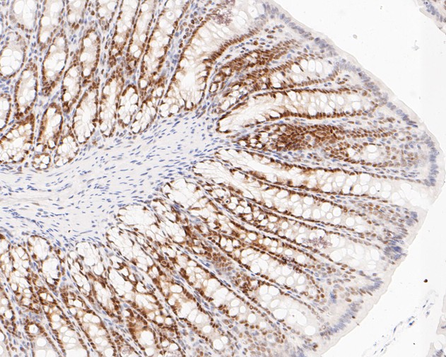 Paraformaldehyde-fixed, paraffin embedded Rat colon; Antigen retrieval by boiling in sodium citrate buffer (pH6.0) for 15min; Block endogenous peroxidase by 3% hydrogen peroxide for 20 minutes; Blocking buffer (normal goat serum) at 37°C for 30min; Antibody incubation with DP1 Monoclonal Antibody, Unconjugated (bsm-54717R) at 1:200 for 30 minutes at room temperature, DAB staining.