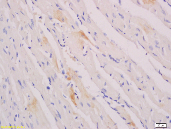Formalin-fixed and paraffin embedded rat heart tissue labeled with Anti MYOG/MYOGENIN Polyclonal Antibody,Unconjugated (bs-3550R) at 1:200 followed by conjugation to the secondary antibody and DAB staining.