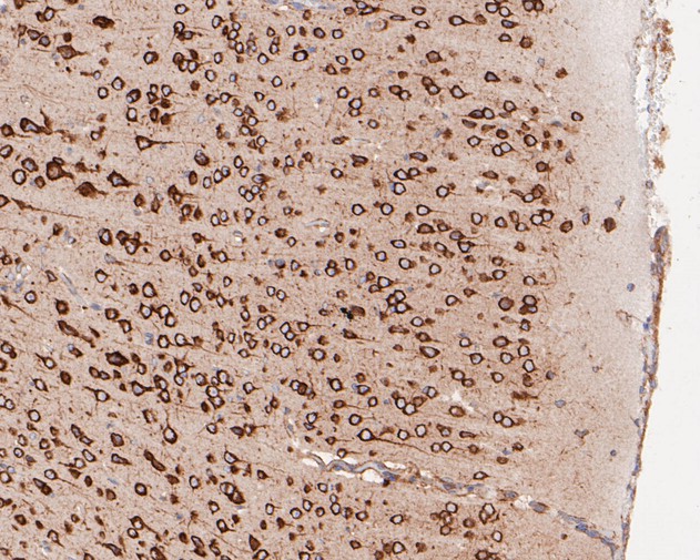 Paraformaldehyde-fixed, paraffin embedded Mouse brain; Antigen retrieval by boiling in sodium citrate buffer (pH6.0) for 15min; Block endogenous peroxidase by 3% hydrogen peroxide for 20 minutes; Blocking buffer (normal goat serum) at 37°C for 30min; Antibody incubation with Elongation factor 1-gamma Monoclonal Antibody, Unconjugated (bsm-54719R) at 1:400 for 30 minutes at room temperature, DAB staining. Paraformaldehyde-fixed, paraffin embedded Mouse brain; Antigen retrieval by boiling in sodium citrate buffer (pH6.0) for 15min; Block endogenous peroxidase by 3% hydrogen peroxide for 20 minutes; Blocking buffer (normal goat serum) at 37°C for 30min; Antibody incubation with Elongation factor 1-gamma Monoclonal Antibody, Unconjugated (bsm-54719R) at 1:400 for 30 minutes at room temperature, DAB staining.