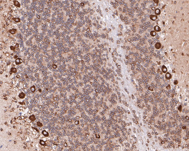 Paraformaldehyde-fixed, paraffin embedded Rat cerebellum; Antigen retrieval by boiling in sodium citrate buffer (pH6.0) for 15min; Block endogenous peroxidase by 3% hydrogen peroxide for 20 minutes; Blocking buffer (normal goat serum) at 37°C for 30min; Antibody incubation with Elongation factor 1-gamma Monoclonal Antibody, Unconjugated (bsm-54719R) at 1:200 for 30 minutes at room temperature, DAB staining.