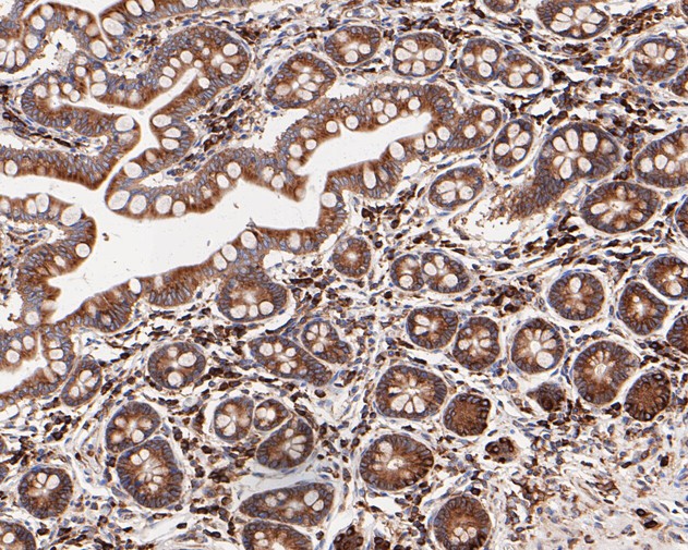 Paraformaldehyde-fixed, paraffin embedded Human intestine; Antigen retrieval by boiling in sodium citrate buffer (pH6.0) for 15min; Block endogenous peroxidase by 3% hydrogen peroxide for 20 minutes; Blocking buffer (normal goat serum) at 37°C for 30min; Antibody incubation with Elongation factor 1-gamma Monoclonal Antibody, Unconjugated (bsm-54719R) at 1:400 for 30 minutes at room temperature, DAB staining.