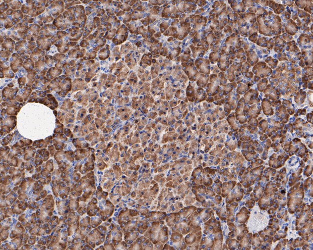 Paraformaldehyde-fixed, paraffin embedded Human pancreas; Antigen retrieval by boiling in sodium citrate buffer (pH6.0) for 15min; Block endogenous peroxidase by 3% hydrogen peroxide for 20 minutes; Blocking buffer (normal goat serum) at 37°C for 30min; Antibody incubation with Elongation factor 1-gamma Monoclonal Antibody, Unconjugated (bsm-54719R) at 1:400 for 30 minutes at room temperature, DAB staining.