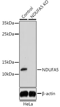 Lane 1: Hela cell lysates; Lane 2: NDUFA5 knockout (KO) HeLa cell lysates probed with NDUFA5 Polyclonal Antibody, Unconjugated (bs-55143R) at 1:1000 dilution and 4˚C overnight incubation. Followed by conjugated secondary antibody incubation at 1:20000 for 60 min at 37˚C.
