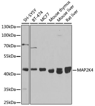 Lane 1: SH-SY5Y cell lysates; Lane 2: BT-474 cell lysates; Lane 3: MCF-7 cell lysates; Lane 4: Mouse Thymus lysates; Lane 5: Mouse Liver lysates; Lane 6: Rat Liver lysates probed with SIRT4 Polyclonal/ Monoclonal Antibody, Unconjugated (bs-55128R) at 1:1000 dilution and 4˚C overnight incubation. Followed by conjugated secondary antibody incubation at 1:20000 for 60 min at 37˚C.