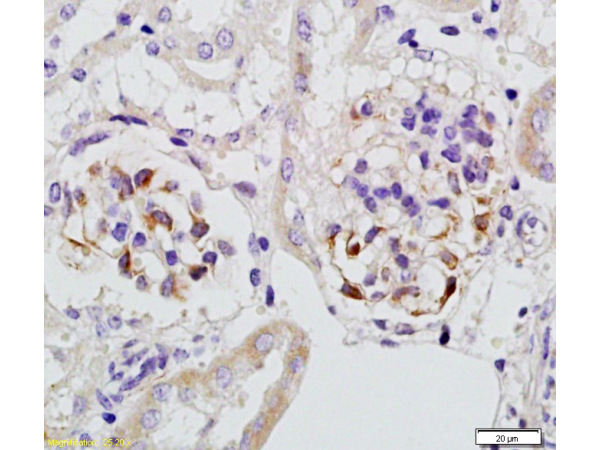 Formalin-fixed and paraffin embedded rat kidney tissue with Anti-Megsin Polyclonal Antibody, Unconjugated (bs-0815R) at 1:200, followed by conjugation to the secondary antibody and DAB staining