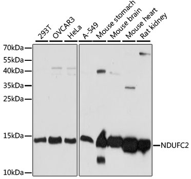 Lane 1: 293T cell lysates; Lane 2: OVCAR3 cell lysates; Lane 3: Hela cell lysates; Lane 4: A549 cell lysates; Lane 5: Mouse Stomach lysates; Lane 6: Mouse Brain lysates; Lane 7: Mouse Heart lysates; Lane 8: Rat Kidney lysates probed with NDUFC2 Polyclonal Antibody, Unconjugated (bs-55146R) at 1:1000 dilution and 4˚C overnight incubation. Followed by conjugated secondary antibody incubation at 1:20000 for 60 min at 37˚C.