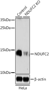 Lane 1: Hela cell lysates; Lane 2: NDUFC2 knockout (KO) HeLa cell lysates probed with NDUFC2 Polyclonal Antibody, Unconjugated (bs-55146R) at 1:1000 dilution and 4˚C overnight incubation. Followed by conjugated secondary antibody incubation at 1:20000 for 60 min at 37˚C. Lane 1: Hela cell lysates; Lane 2: NDUFC2 knockout (KO) HeLa cell lysates probed with NDUFC2 Polyclonal Antibody, Unconjugated (bs-55146R) at 1:1000 dilution and 4˚C overnight incubation. Followed by conjugated secondary antibody incubation at 1:20000 for 60 min at 37˚C.