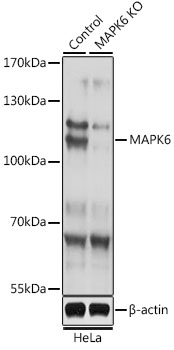 Lane 1: Hela cell lysates; Lane 2: MAPK6 knockout (KO) HeLa cell lysates probed with MAPK6 Polyclonal Antibody, Unconjugated (bs-55129R) at 1:1000 dilution and 4˚C overnight incubation. Followed by conjugated secondary antibody incubation at 1:20000 for 60 min at 37˚C.