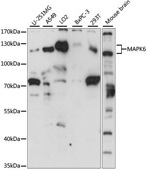 Lane 1: U-251MG cell lysates; Lane 2: A549 cell lysates; Lane 3: LO2 cell lysates; Lane 4: BxPC-3 cell lysates; Lane 5: 293T cell lysates; Lane 6: Mouse Brain lysates probed with MAPK6 Polyclonal Antibody, Unconjugated (bs-55129R) at 1:1000 dilution and 4˚C overnight incubation. Followed by conjugated secondary antibody incubation at 1:20000 for 60 min at 37˚C.