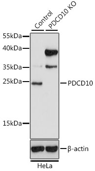 Lane 1: Hela cell lysates; Lane 2: PDCD10 knockout (KO) HeLa cell lysates probed with PDCD10 Polyclonal Antibody, Unconjugated (bs-55165R) at 1:1000 dilution and 4˚C overnight incubation. Followed by conjugated secondary antibody incubation at 1:20000 for 60 min at 37˚C.