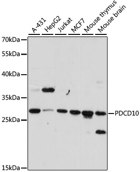 Lane 1: A431 cell lysates; Lane 2: HepG2 cell lysates; Lane 3: Jurkat cell lysates; Lane 4: MCF-7 cell lysates; Lane 5: Mouse Thymus lysates; Lane 6: Mouse Brain lysates probed with PDCD10 Polyclonal Antibody, Unconjugated (bs-55165R) at 1:1000 dilution and 4˚C overnight incubation. Followed by conjugated secondary antibody incubation at 1:20000 for 60 min at 37˚C.