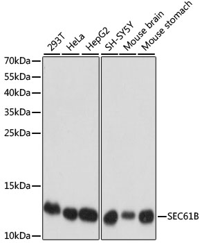 Lane 1: 293T cell lysates; Lane 2: Hela cell lysates; Lane 3: HepG2 cell lysates; Lane 4: SH-SY5Y cell lysates; Lane 5: Mouse Brain lysates; Lane 6: Mouse Stomach lysates probed with SEC61B Polyclonal Antibody, Unconjugated (bs-55194R) at 1:1000 dilution and 4˚C overnight incubation. Followed by conjugated secondary antibody incubation at 1:20000 for 60 min at 37˚C.