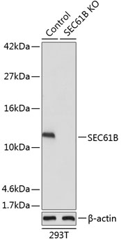 Lane 1: 293T cell lysates; Lane 2: SEC61B knockout (KO) 293T cell lysates probed with SEC61B Polyclonal Antibody, Unconjugated (bs-55194R) at 1:1000 dilution and 4˚C overnight incubation. Followed by conjugated secondary antibody incubation at 1:20000 for 60 min at 37˚C.