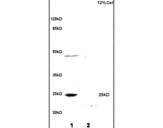 Lane 1: rat heart lysates Lane 2: mouse skeletal muscle lysates probed with Anti MYOG/MYOGENIN Polyclonal Antibody, Unconjugated (bs-3550R) at 1:200 in 4˚C. Followed by conjugation to secondary antibody (bs-0295G-HRP) at 1:3000 90min in 37˚C. Predicted band 25kD. Observed band size: 25kD.