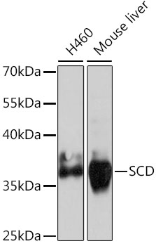 Lane 1: H460 cell lysates; Lane 2: Mouse Liver lysates probed with SCD Polyclonal Antibody, Unconjugated (bs-55193R) at 1:1000 dilution and 4˚C overnight incubation. Followed by conjugated secondary antibody incubation at 1:20000 for 60 min at 37˚C.