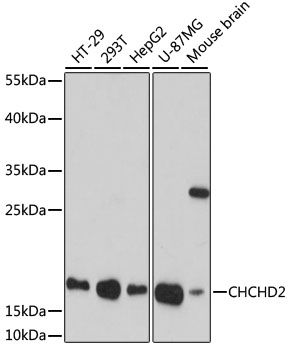 Lane 1: HT-29 cell lysates; Lane 2: 293T cell lysates; Lane 3: HepG2 cell lysates; Lane 4: U-87MG cell lysates; Lane 5: Mouse Brain lysates probed with CHCHD2 Polyclonal Antibody, Unconjugated (bs-55042R) at 1:1000 dilution and 4˚C overnight incubation. Followed by conjugated secondary antibody incubation at 1:20000 for 60 min at 37˚C.