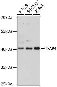 Lane 1: HT-29 cell lysates; Lane 2: SGC7901 cell lysates; Lane 3: 22Rv1 cell lysates probed with TFAP4 Polyclonal Antibody, Unconjugated (bs-55214R) at 1:1000 dilution and 4˚C overnight incubation. Followed by conjugated secondary antibody incubation at 1:20000 for 60 min at 37˚C.