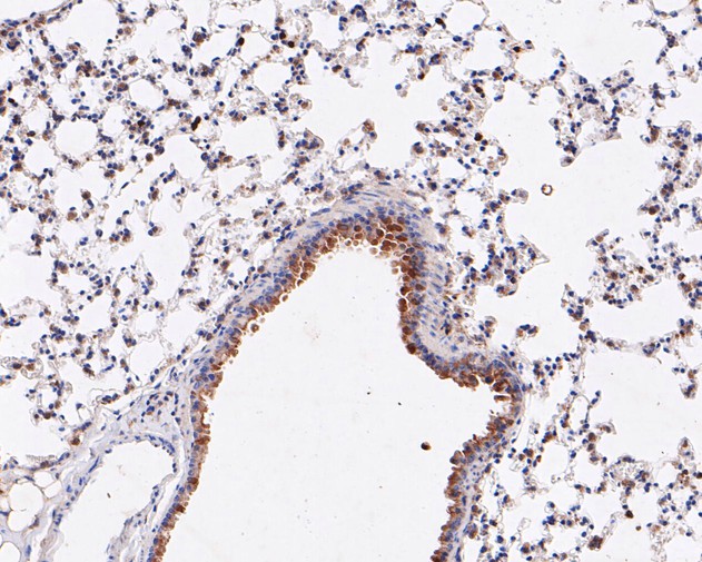 Paraformaldehyde-fixed, paraffin embedded Mouse liver; Antigen retrieval by boiling in sodium citrate buffer (pH6.0) for 15min; Block endogenous peroxidase by 3% hydrogen peroxide for 20 minutes; Blocking buffer (normal goat serum) at 37°C for 30min; Antibody incubation with ARF5 Monoclonal Antibody, Unconjugated (bsm-54720R) at 1:50 for 30 minutes at room temperature, DAB staining.