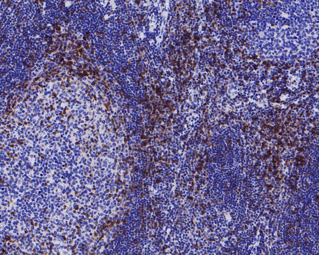 Paraformaldehyde-fixed, paraffin embedded Human tonsil; Antigen retrieval by boiling in sodium citrate buffer (pH6.0) for 15min; Block endogenous peroxidase by 3% hydrogen peroxide for 20 minutes; Blocking buffer (normal goat serum) at 37°C for 30min; Antibody incubation with CD5 Monoclonal Antibody, Unconjugated (bsm-54722R) at 1:200 for 30 minutes at room temperature, DAB staining. Paraformaldehyde-fixed, paraffin embedded Human tonsil; Antigen retrieval by boiling in sodium citrate buffer (pH6.0) for 15min; Block endogenous peroxidase by 3% hydrogen peroxide for 20 minutes; Blocking buffer (normal goat serum) at 37°C for 30min; Antibody incubation with CD5 Monoclonal Antibody, Unconjugated (bsm-54722R) at 1:200 for 30 minutes at room temperature, DAB staining.