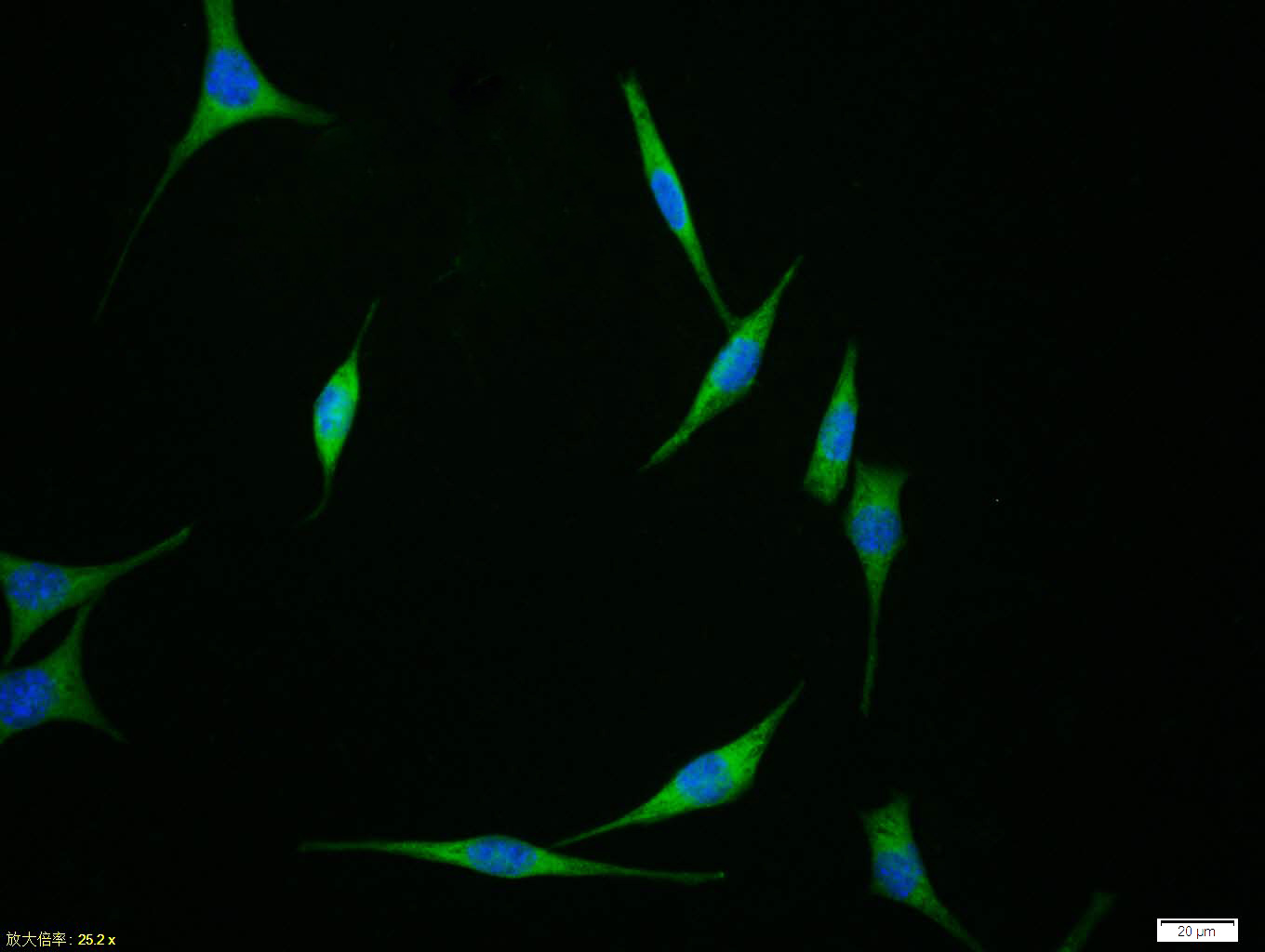 Tissue/cell:SH-SY5Y cell; 4% Paraformaldehyde-fixed; Triton X-100 at room temperature for 20 min; Blocking buffer (normal goat serum,C-0005) at 37°C for 20 min; Antibody incubation with (APAF1(CT)) polyclonal Antibody, Unconjugated (bs-0058R) 1:100, 90 minutes at 37°C; followed by a FITC conjugated Goat Anti-Rabbit IgG antibody at 37°C for 90 minutes, DAPI (blue, C02-04002) was used to stain the cell nuclei.