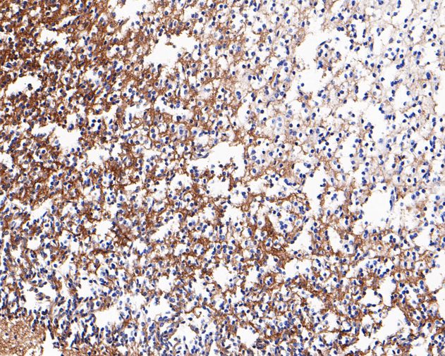 Paraformaldehyde-fixed, paraffin embedded Human brain; Antigen retrieval by boiling in sodium citrate buffer (pH6.0) for 15min; Block endogenous peroxidase by 3% hydrogen peroxide for 20 minutes; Blocking buffer (normal goat serum) at 37°C for 30min; Antibody incubation with Neurocan Monoclonal Antibody, Unconjugated (bsm-54723R) at 1:200 for 30 minutes at room temperature, DAB staining.