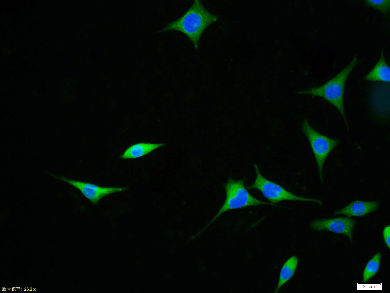 Tissue/cell:SH-SY5Y cell; 4% Paraformaldehyde-fixed; Triton X-100 at room temperature for 20 min; Blocking buffer (normal goat serum,C-0005) at 37°C for 20 min; Antibody incubation with (APAF1(NT)) polyclonal Antibody, Unconjugated (bs-0059R) 1:100, 90 minutes at 37°C; followed by a FITC conjugated Goat Anti-Rabbit IgG antibody at 37°C for 90 minutes, DAPI (blue, C02-04002) was used to stain the cell nuclei.