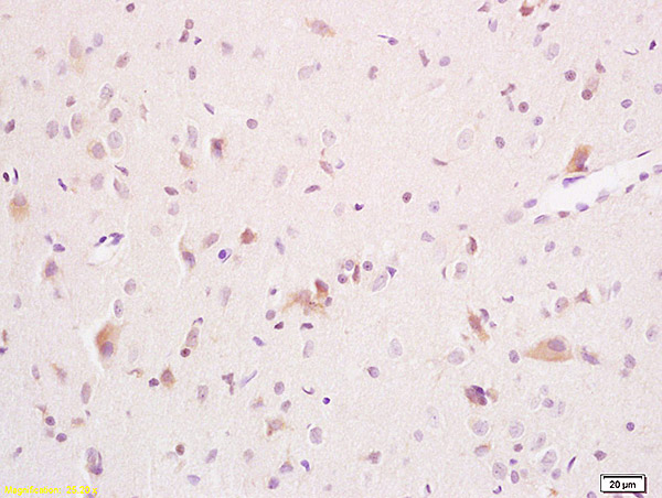 Formalin-fixed and paraffin embedded rat brain tissue labeled with Anti ARSA Polyclonal Antibody,Unconjugated (bs-4006R) at 1:200 followed by conjugation to the secondary antibody and DAB staining.