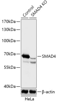 Lane 1: Hela cell lysates; Lane 2: SMAD4 knockout (KO) HeLa cell lysates probed with SMAD4 Polyclonal Antibody, Unconjugated (bs-55202R) at 1:1000 dilution and 4˚C overnight incubation. Followed by conjugated secondary antibody incubation at 1:20000 for 60 min at 37˚C.