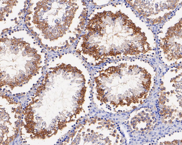 Paraformaldehyde-fixed, paraffin embedded Mouse testis; Antigen retrieval by boiling in sodium citrate buffer (pH6.0) for 15min; Block endogenous peroxidase by 3% hydrogen peroxide for 20 minutes; Blocking buffer (normal goat serum) at 37°C for 30min; Antibody incubation with CHMP2B Monoclonal Antibody, Unconjugated (bsm-54727R) at 1:100 for 30 minutes at room temperature, DAB staining.