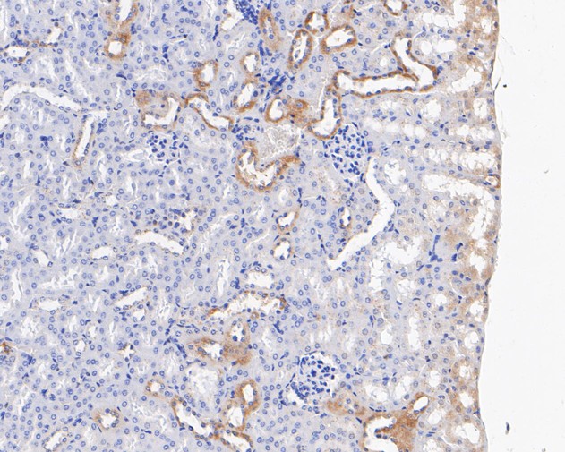 Paraformaldehyde-fixed, paraffin embedded Mouse kidney; Antigen retrieval by boiling in sodium citrate buffer (pH6.0) for 15min; Block endogenous peroxidase by 3% hydrogen peroxide for 20 minutes; Blocking buffer (normal goat serum) at 37°C for 30min; Antibody incubation with CHMP2B Monoclonal Antibody, Unconjugated (bsm-54727R) at 1:100 for 30 minutes at room temperature, DAB staining.