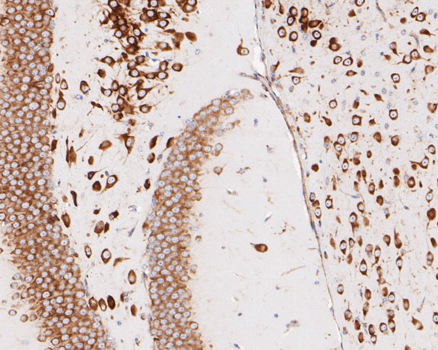 Paraformaldehyde-fixed, paraffin embedded Mouse brain; Antigen retrieval by boiling in sodium citrate buffer (pH6.0) for 15min; Block endogenous peroxidase by 3% hydrogen peroxide for 20 minutes; Blocking buffer (normal goat serum) at 37°C for 30min; Antibody incubation with RPL7A Monoclonal Antibody, Unconjugated (bsm-54730R) at 1:50 for 30 minutes at room temperature, DAB staining.