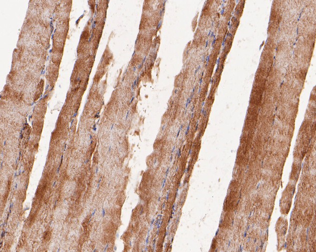 Paraformaldehyde-fixed, paraffin embedded Rat smooth muscle; Antigen retrieval by boiling in sodium citrate buffer (pH6.0) for 15min; Block endogenous peroxidase by 3% hydrogen peroxide for 20 minutes; Blocking buffer (normal goat serum) at 37°C for 30min; Antibody incubation with GOT2 Monoclonal Antibody, Unconjugated (bsm-54731R) at 1:50 for 30 minutes at room temperature, DAB staining.